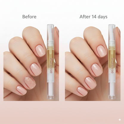 4x Puresse Nail Strengthener Serum
